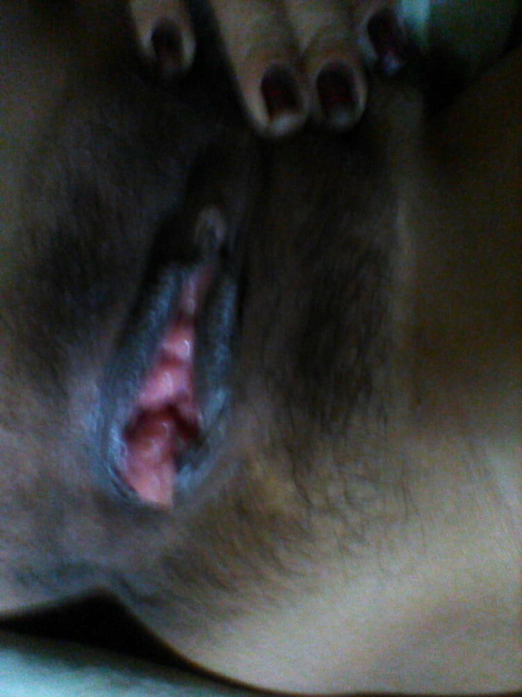 510_1000-2020-4675906